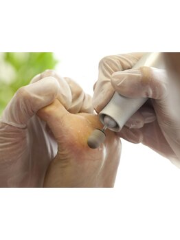 角質ケアができるサロン