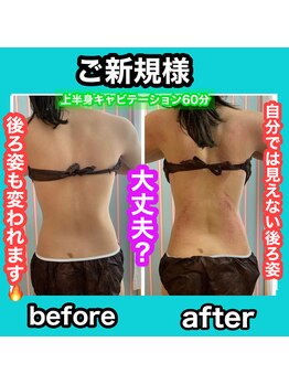 ビューティ ウィッチ(Beauty Witch)/後ろ姿大丈夫？