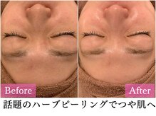 マイン(mine)/陶肌トリートメントでツヤ肌に♪