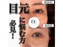 ラフィーユ 豊崎本店(La fille)の雰囲気（40代~50代のお客様もダウンタイム無しのアイパワーエステ！）
