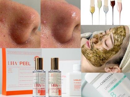 ピース(PEACE)の写真