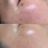 エムクレア(M.clair)