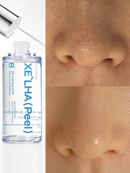 お肌をきれいにしたい