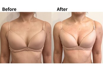 バストケア&アロマリンパセラピーnicco/