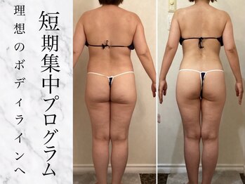 美ジン なかもず(美JIN)の写真/「夏までに本気のダイエット！最新痩身マシンで理想のボディラインに！」運動苦手な方にも◎