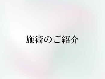 ヨーニ(YooNi)/幅広いメニューをご用意