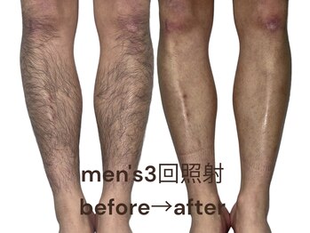 テンピスモ(tempismo)の写真/結果重視で必要以上の会話や無理な勧誘なし!毎回同じ担当だから初めての脱毛も安心してお任せ下さい。