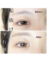 シュシュ(chou chou)/