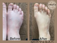 アムール 麻布十番(Amour)/痩身ウェルスパ微弱電流