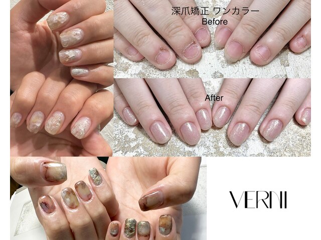 VERNI【ヴェルニ】