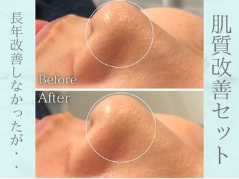 ネオファースト(NeoFirst)/長年の汚れの蓄積も解決♪