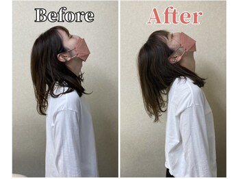 整体ラルース 中目黒(LALUZ)/30代 女性 ストレートネック改善