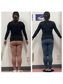 いわき美容整体院/痩身骨盤矯正 産後の骨盤矯正