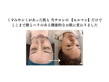 スタッフも【セルマン】で美肌へと変わりました！