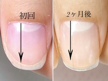 トゥインクリーネイルサロン(Twinkly Nail Salon)/【地爪育成】1回お試し