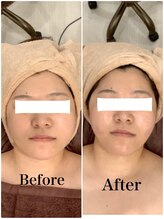 スペチアーレ 夙川/小顔で周りと差をつける！