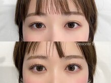 クレセントアイ 吉祥寺(Crescent Eye)/次世代まつげパーマ/マツパ
