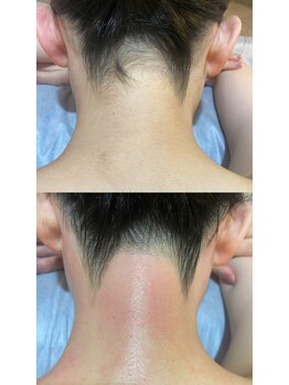 ブラジリアンワックス脱毛サロン アンベリール(Embellir)/《wax脱毛》