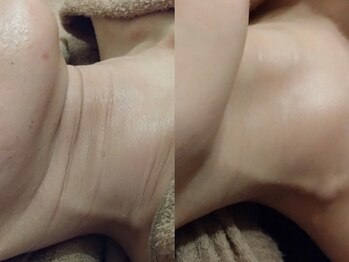 ディアナ 代々木上原(_Diana)/グリーンピール/Diana代々木上原