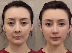 【２周年記念】小顔お試しコース40分 ￥5,000《メンズも大歓迎》