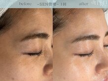 スキンラボアメリ(skin lab. ameri)/お悩み…くすみしわ