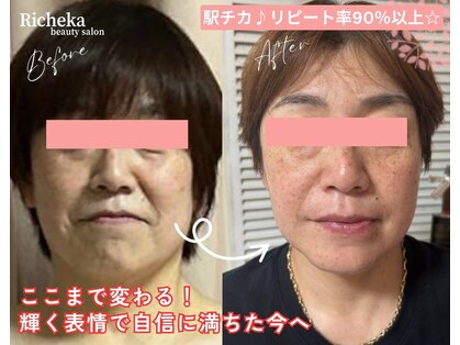 リシェカ(Richeka)の写真