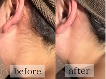 グランビューティ(Glanz Beauty)/20代女性