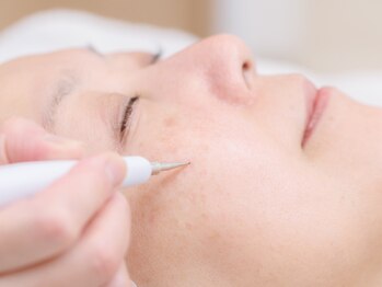 クラリス(Clarice)/シミケア・イボケア・ホクロに