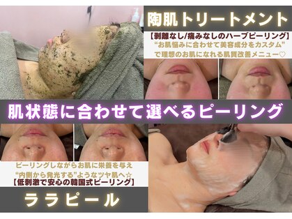 バルディーナ(BALDINA)の写真