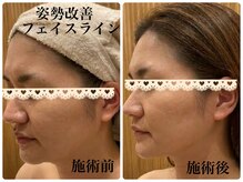 エピファニー(Epi phany Total Beauty Salon)の雰囲気（フェイシャルラインのもたつき改善/美姿勢と脂肪燃焼で小顔に）