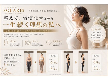 ソラリス(SOLARIS)の写真