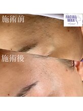 デニム(Denim)/化粧水の浸透が格段に良くなり、