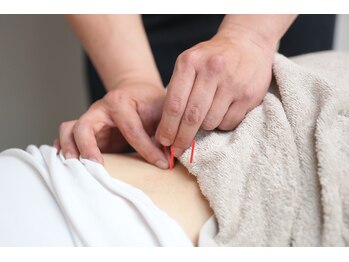 みなみ鍼灸整骨院/施術風景2