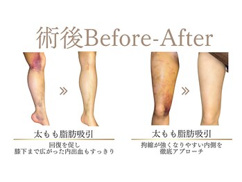 マドモアゼル 麻布十番