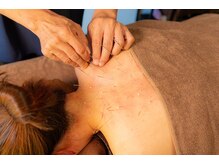 はりひろし鍼灸院/