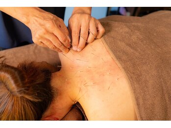 はりひろし鍼灸院/