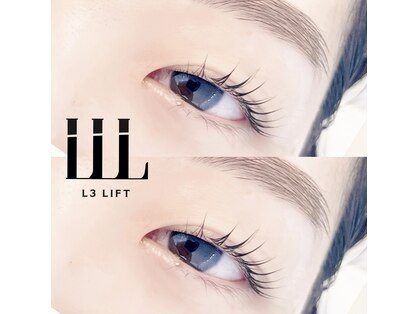 アリイ(ALII)の写真