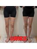 【女性のみ】O脚矯正＋骨盤矯正初回クーポン¥8100→
