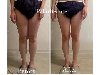 パームボーテ(Palm Beaute)/脚スッキリ！むくみ撃退