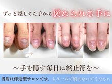 ブルームーンネイルズ(BLOOMOON.nails)