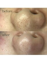 ファイブエレガンテ(5Elegante)/