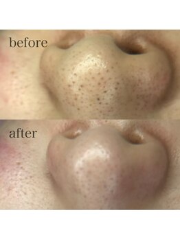 ファイブエレガンテ(5Elegante)/