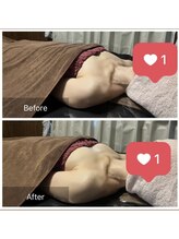 リノレア(LinoLea)/バストアップBefore after