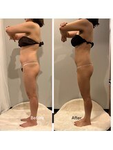 ソウソウビューティー 五反田(Shou Shou Beauty)/ビフォー☆アフター