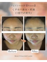 クレール(Claire)/【フェイシャルSP】トーンアップ