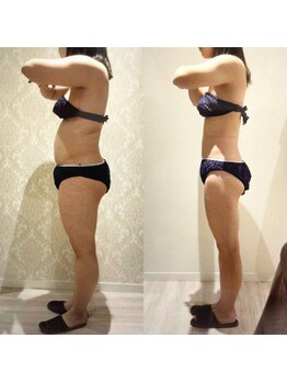 アユアランリンク 札幌店/20代前半/約5ヵ月/-15kg/側面