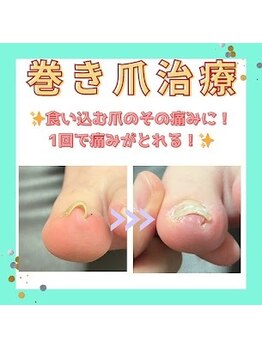 かがわ接骨院 高松伏石院/歩くときに痛みがある方へ!