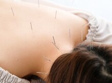 トランク鍼灸院 整骨院(TRUNK鍼灸院 整骨院)