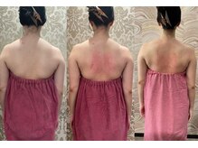 ロココ 錦糸町店(Rococo)/比較写真