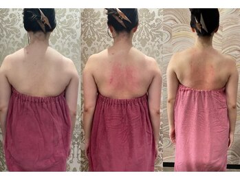 ロココ 錦糸町店(Rococo)/比較写真